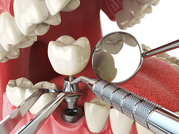 Best Pediatric Emergency Dentist in Wakeman, OH